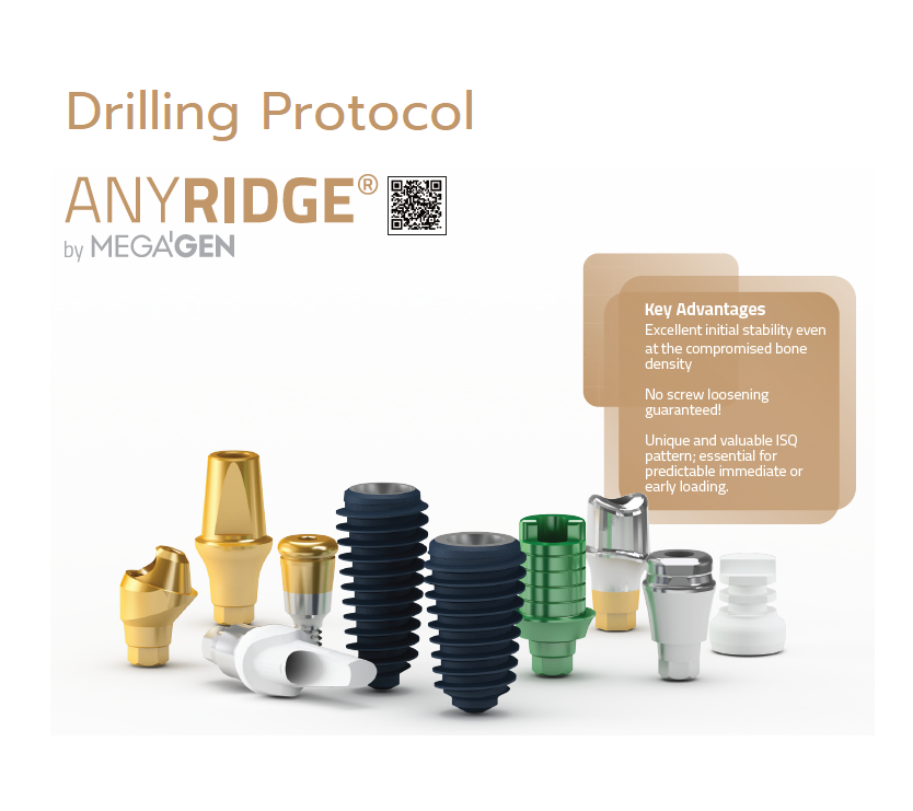 MegaGen AnyRidge drilling protocol